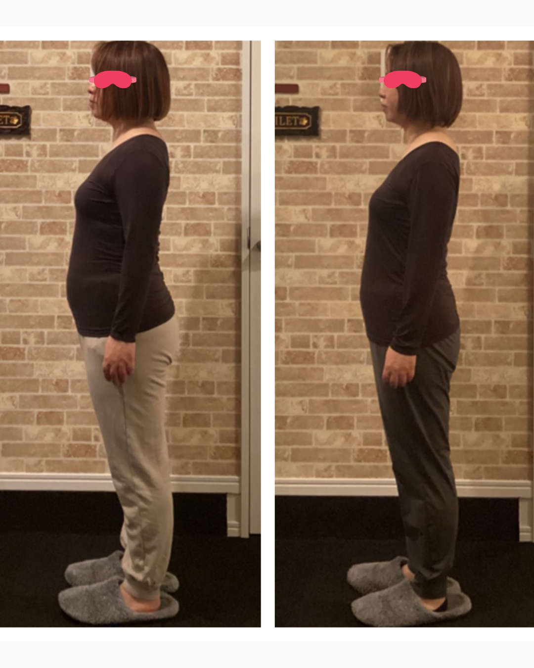40代後半女性の姿勢改善と−7kgダイエットのビフォーアフター